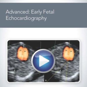 American Institute of Ultrasound in Medicine Advanced Early Fetal Echocardiography 2020