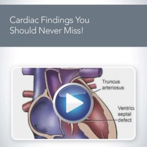 American Institute of Ultrasound in Medicine Cardiac Findings You Should Never Miss 2020