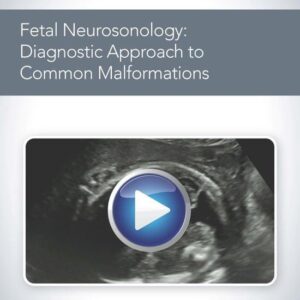 American Institute of Ultrasound in Medicine Fetal Neurosonology Diagnostic Approach to Common Malformations 2020