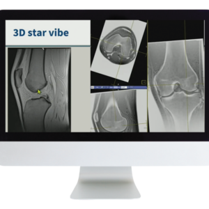 American Roentgen Ray Society 3D MR Imaging of Joints with Arthroscopy Correlations 2023
