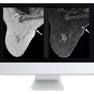 American Roentgen Ray Society Clinical Breast Imaging Review 2009