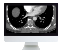 American Roentgen Ray Society Clinical Cardiopulmonary Imaging Review 2017
