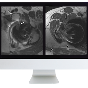 American Roentgen Ray Society Controversies in Hip and Pelvis Imaging 2016