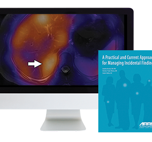 American Roentgen Ray Society Managing Incidental Findings A Practical and Current Approach 2017