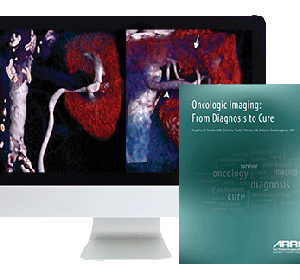 American Roentgen Ray Society Oncologic Imaging From Diagnosis to Cure 2016