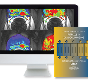 American Roentgen Ray Society Pitfalls in Clinical Imaging 2008