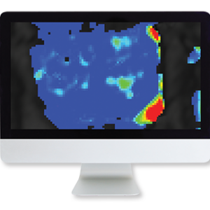 American Roentgen Ray Society Prostate MRI A Practice-Based Approach 2016