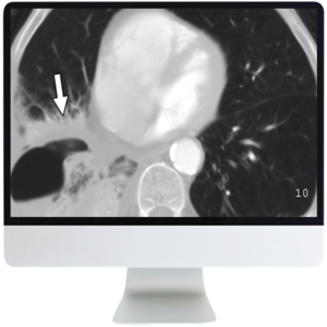 American Roentgen Ray Society Radiology Review Multispecialty Cases Online Course 2019