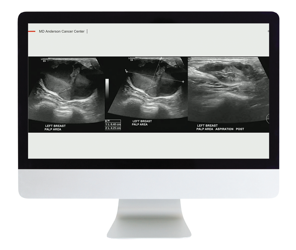 American Roentgen Ray Society Reading Cases with the Experts An Interactive Session Part 2 2023