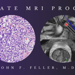 CME Science Prostate MRI (Program 1) – John F. Feller, M.D 2021