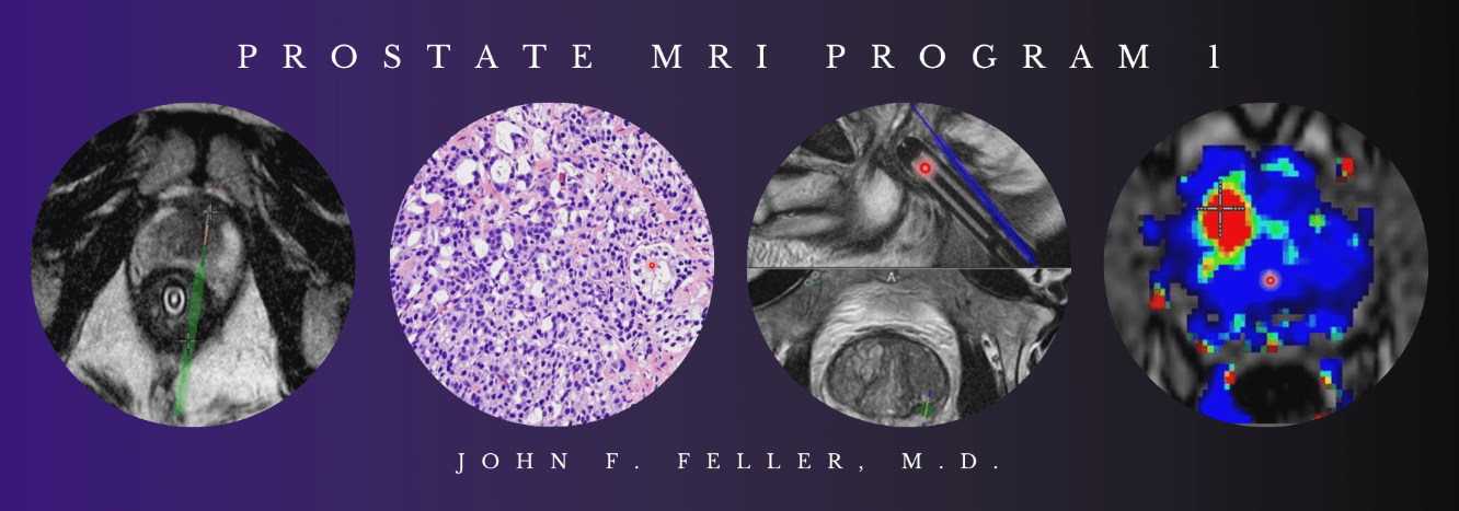 CME Science Prostate MRI (Program 1) – John F. Feller, M.D 2021