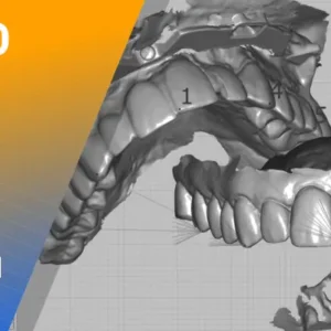 DigitalDDS EXOCAD AOX Advanced EXOCAD for all things AOX