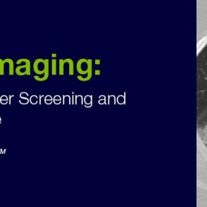 DocmedED 2020 Lung Imaging Highlighting Lung Cancer Screening and Interstitial Lung Disease