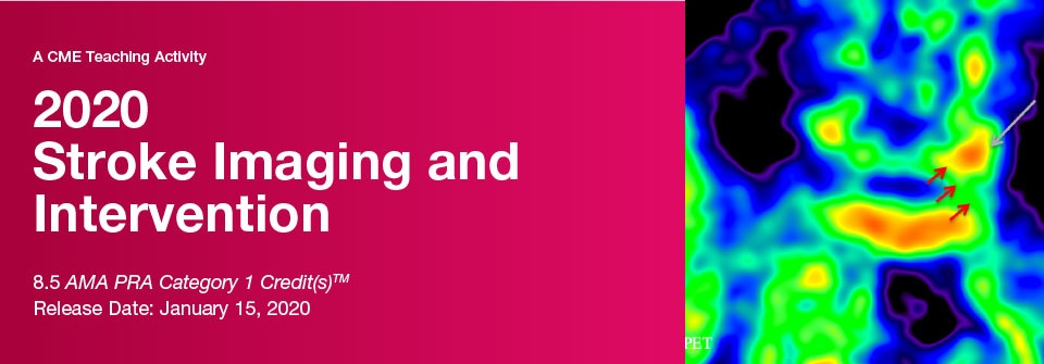 DocmedED 2020 Stroke Imaging and Intervention