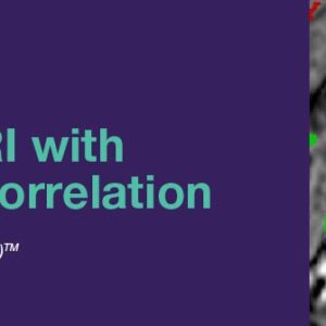 DocmedED 2020 Updates in Prostate MRI with Pathology Correlation