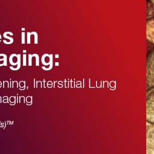 DocmedED 2020 Updates in Thoracic Imaging Highlighting Lung Screening, Interstitial Lung Disease, and Cardiac Imaging