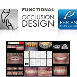 Functional Occlusion Design Dental Seminars