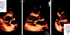 Mayo Clinic Echocardiography Board Review 2019-2020
