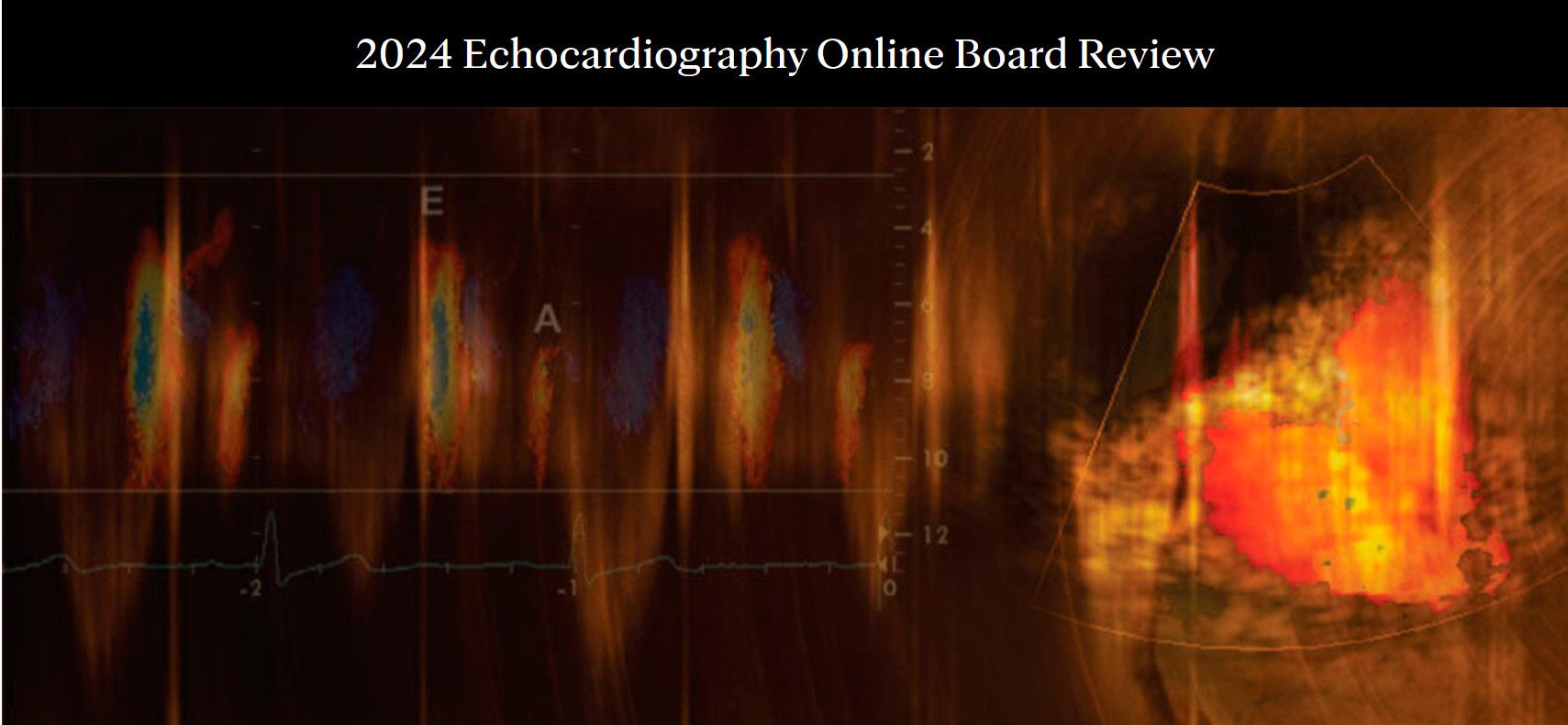 Mayo Clinic Echocardiography Online Board Review 2024