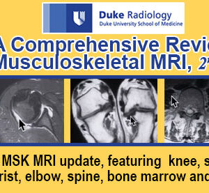 Meetings By Mail Duke Radiology - A Comprehensive Review of Musculoskeletal MRI, 2nd 2016