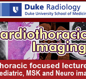 Meetings By Mail Duke Radiology - Cardiothoracic Imaging Plus 2016