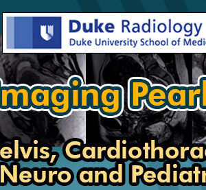 Meetings By Mail Duke Radiology - Imaging Pearls - Pelvis, Cardiothoracic, Neuro and Pediatric 2018