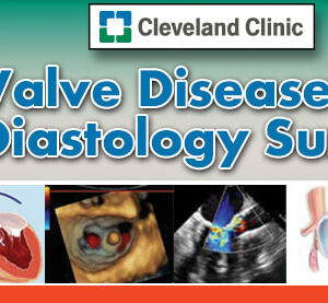 Meetings By Mail 18th Valve Disease, Structural Interventions and Diastology Summit 2016