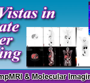 Meetings By Mail New Vistas in Prostate Cancer Imaging 2022