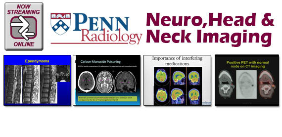 Meetings By Mail Penn Radiology Neuro, Head & Neck Imaging 2013