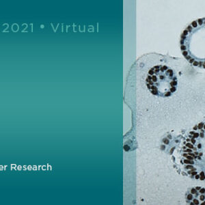 Memorial Sloan Kettering Cancer Center Pancreas Cancer Symposium The Current and the Future 2021