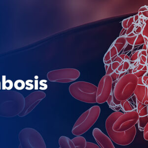 Memorial Sloan Kettering Cancer Center State-of-the-Art in Benign Hematology, Hemostasis, and Thrombosis 2025