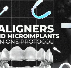 OHI-S Aligners And Microimplants In One Protocol