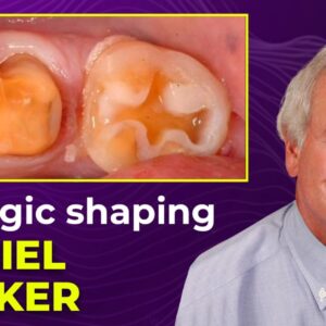 OHI-S Biologic Shaping a conservative alternative to crown lengthening 4 lessons 1h 54m
