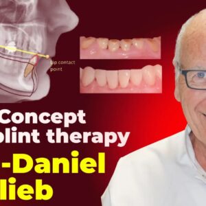 OHI-S OCTA concept and splint therapy