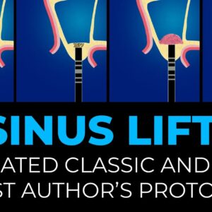 OHI-S Sinus Lift Updated Classic and the Latest Author's Protocols