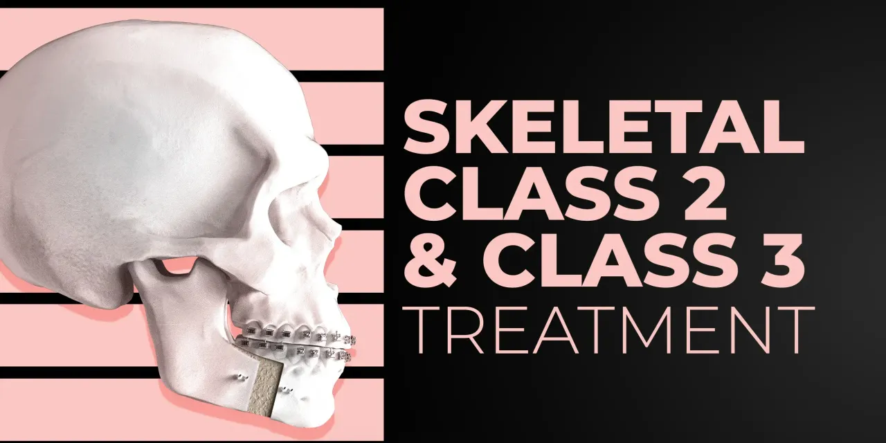 OHI-S Skeletal Class 2 & Class 3 treatment team approach orthodontist-surgeon