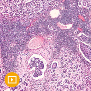 Oakstone Breast Pathology 2023