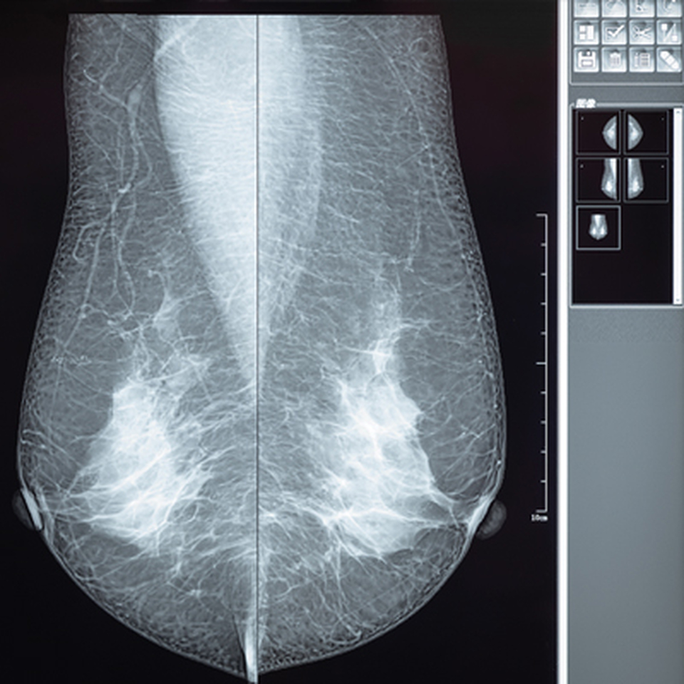 Oakstone Comprehensive Review of Breast Imaging 2022