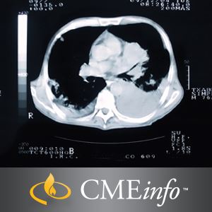 Oakstone Lung Cancer Imaging 2016