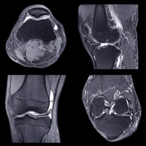 Oakstone NYU Langone Advanced Imaging of the Musculoskeletal System Up Your Game 2023