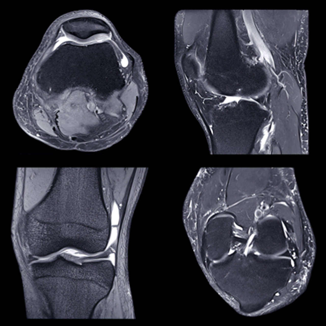 Oakstone NYU Langone Advanced Imaging of the Musculoskeletal System Up Your Game 2023