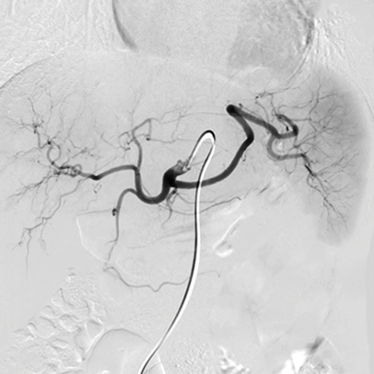 Oakstone NYU Langone Vascular and Interventional Radiology Review and Update 2023