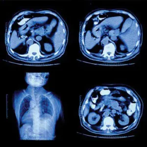 Oakstone UCSF Abdominal & Thoracic Imaging 2022