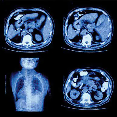 Oakstone UCSF Abdominal & Thoracic Imaging 2022