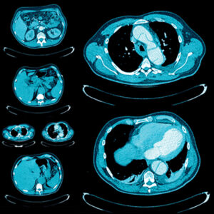 Oakstone UCSF Abdominal & Thoracic Imaging 2025
