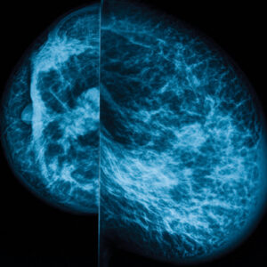 Oakstone UCSF Breast Imaging 2024