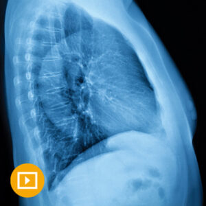 Oakstone UCSF Thoracic Imaging 2023