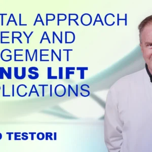Osteocom Crestal Approach Surgery and Management Of Sinus Lift Complications