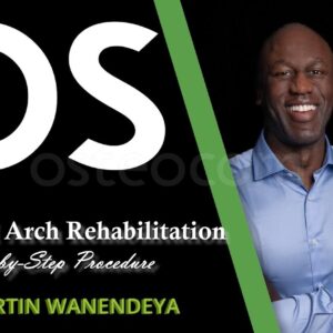 Osteocom FP1 - Full Arch Rehabilitation Step-by-Step Procedure