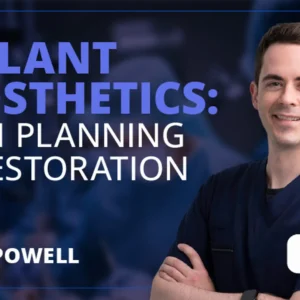 Osteocom Implant Prosthetics from Planning to Restoration